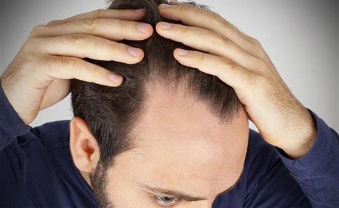 吃什么食物能预防脱发？中年男人脱发怎么办？